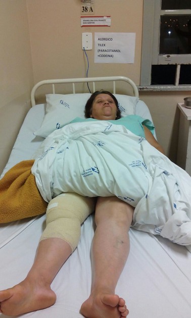 Cirurgia é realizada em perna errada no hospital de Mafra (3)