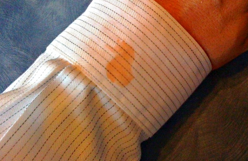 Manchas de gordura na roupa Saiba como remover