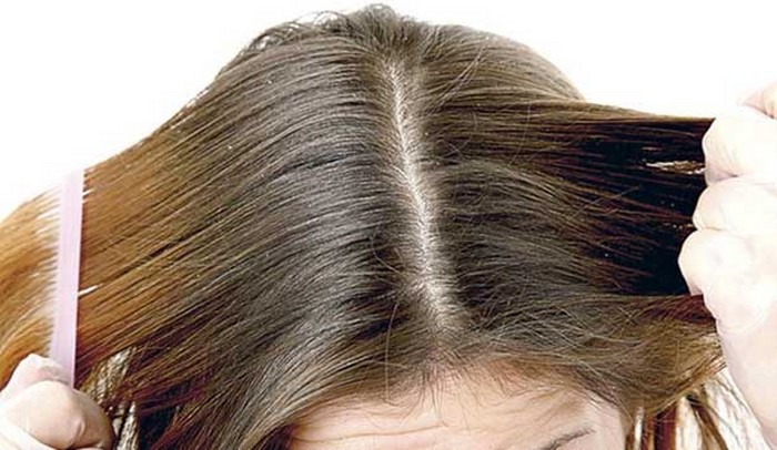 Dica para controlar a caspa