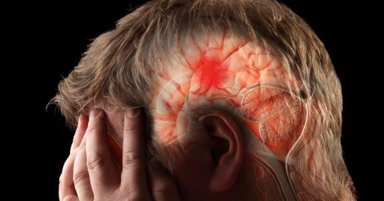 29 de outubro Dia Mundial de Combate ao Acidente Vascular